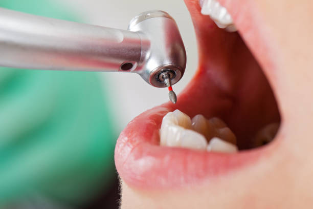 Best Emergency Root Canal Treatment in Crawford, GA